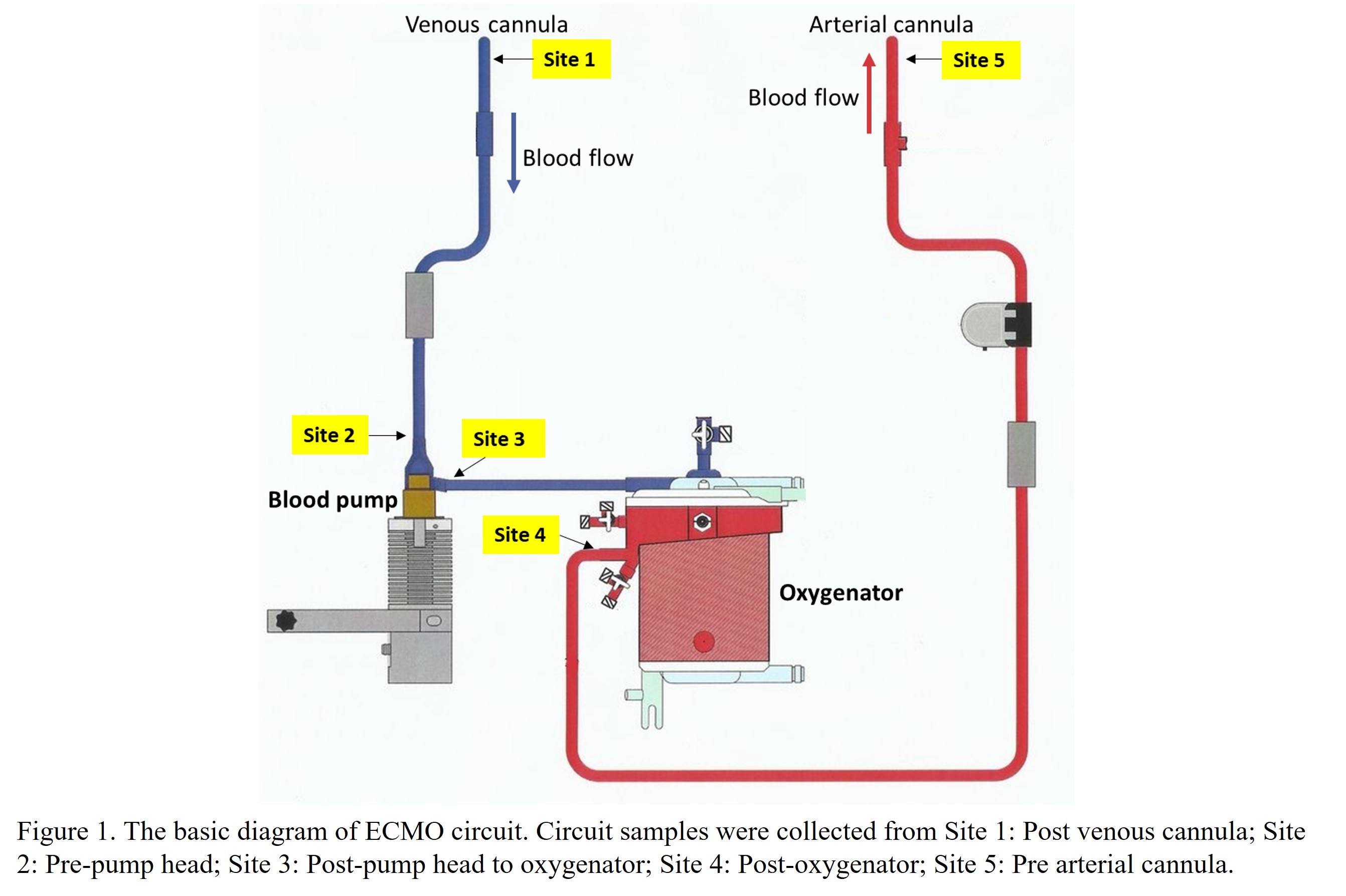 636c7953b13a6-Figure+1.+The+basic+diagram+of+ECMO+circuit..jpg