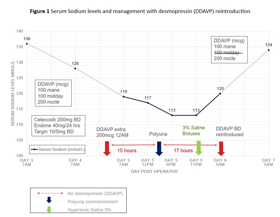 68711991019c1-Figure+1+Serum+Sodium+levels+and+management+with+desmopressin+(DDAVP)+reintroduction.jpg