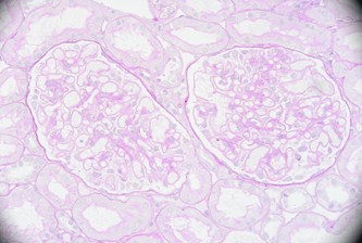 6864518d50ad6-Periodic+Acid-Schiff+Staining.jpg