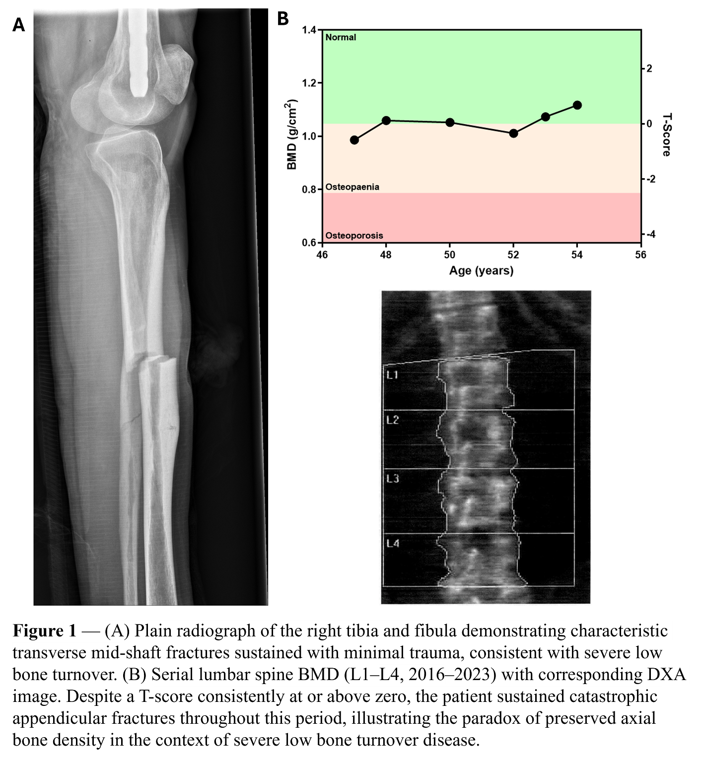 69dc597a047fd-CC_Fig1_f.png